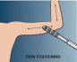 Preview: Lunavit Energystick ES-1 Akupressur Vibrationsmassagegerät